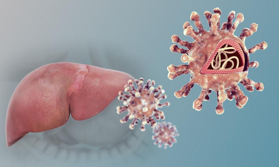 Muertes anuales por hepatitis virales equivalen a las víctimas de dos pandemias de coronavirus
