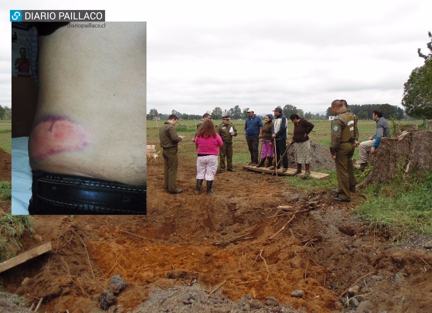 Tensión en Itropulli: Dos comuneros mapuche heridos tras ataque de encapuchados