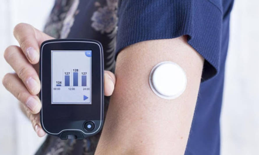 Buscan que gobierno apure incorporación de sensores digitales para diabetes en canasta GES