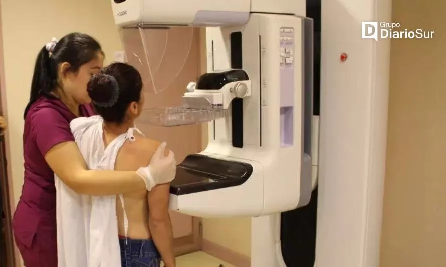 Mamografías podrían realizarse sin orden médica: proyecto avanza en el Senado