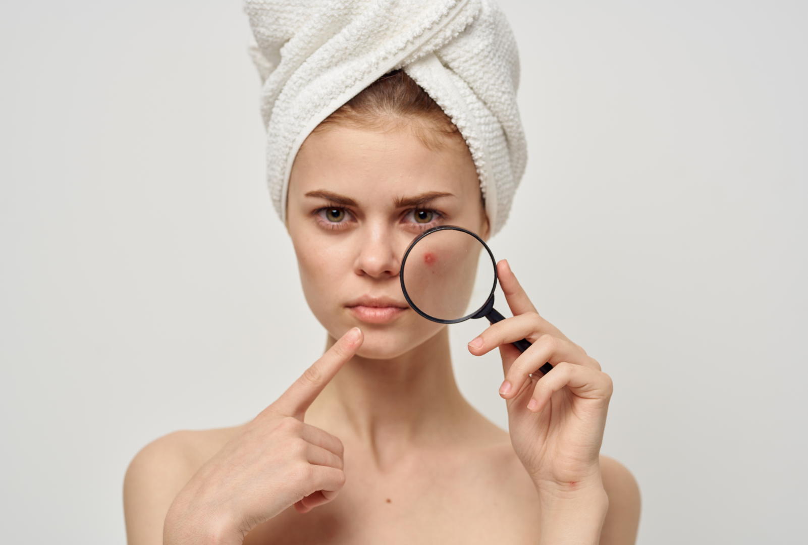 Tipos de acné: conoce los 6 tipos de afecciones más comunes