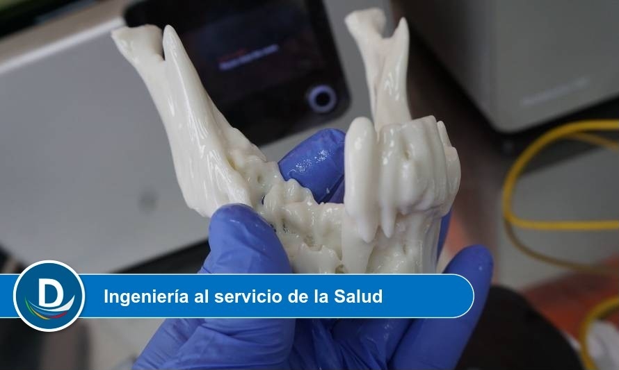 Laboratorio UACh LeufüLab desarrolla placas maxilofaciales con impresoras 3D